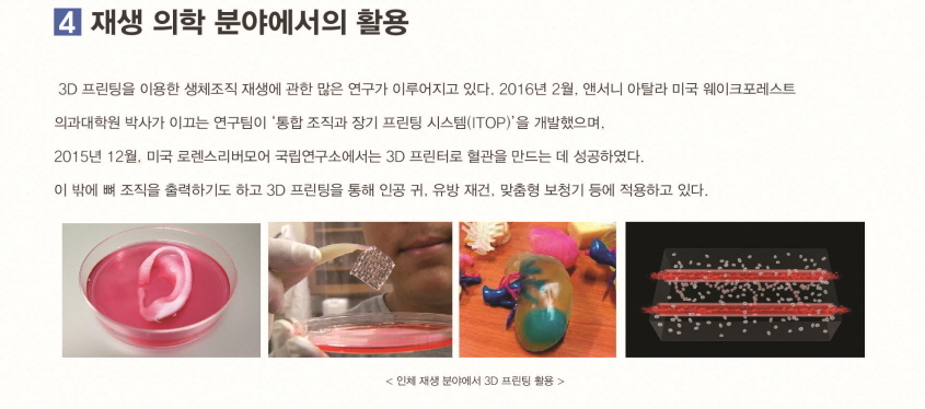 재생 의학 분야에서의 활용