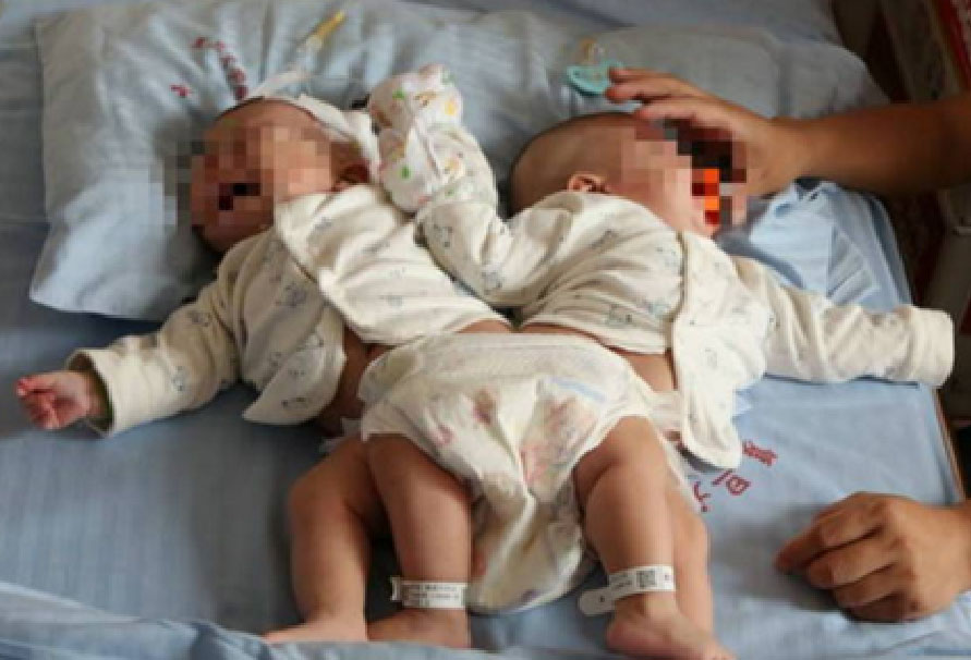 의료기기 이미지