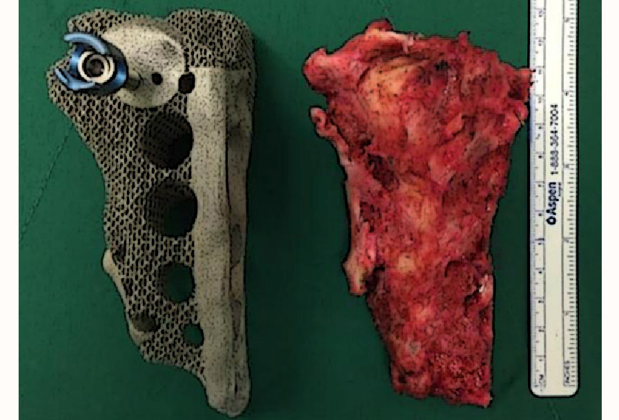 의료기기 이미지