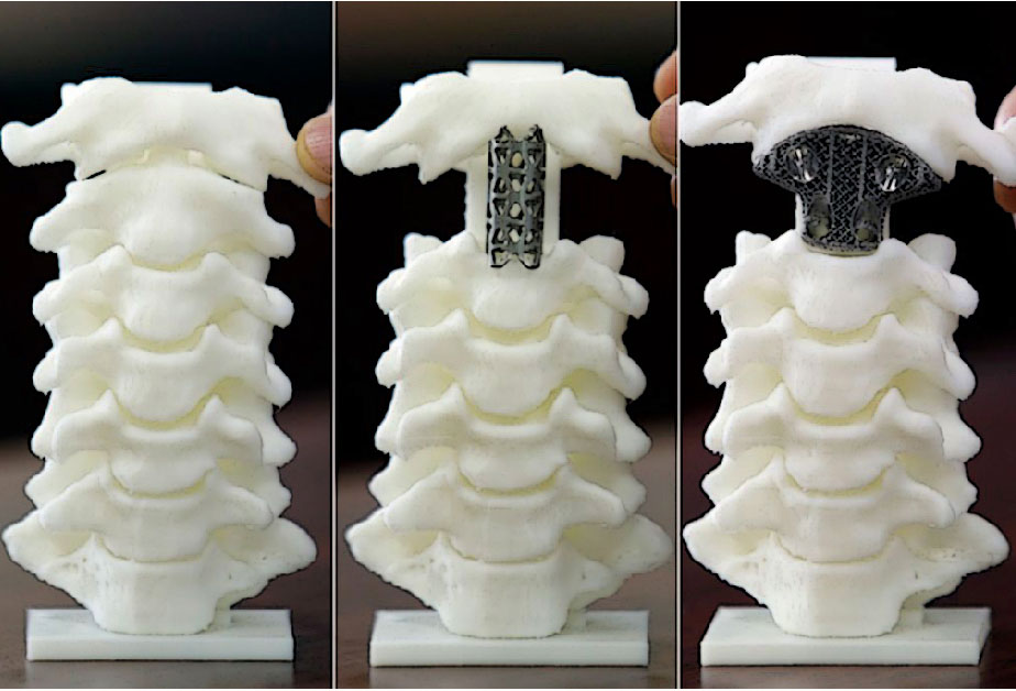 인체이식 이미지