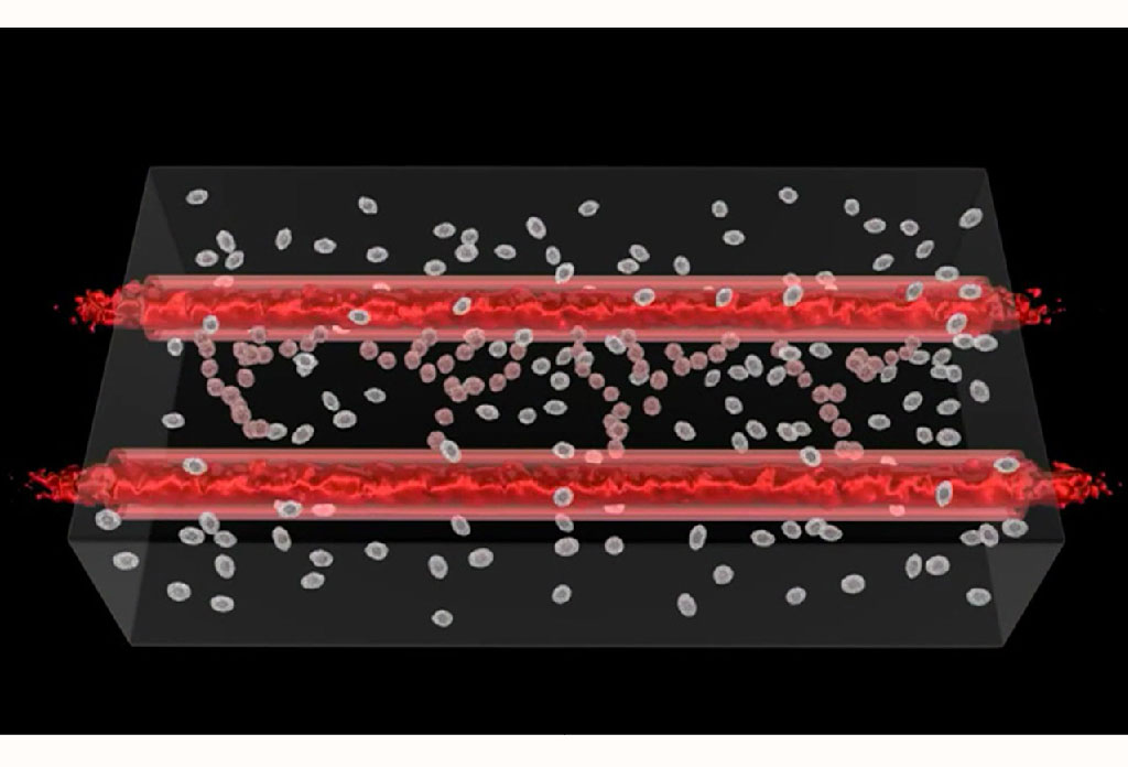 인체이식 이미지
