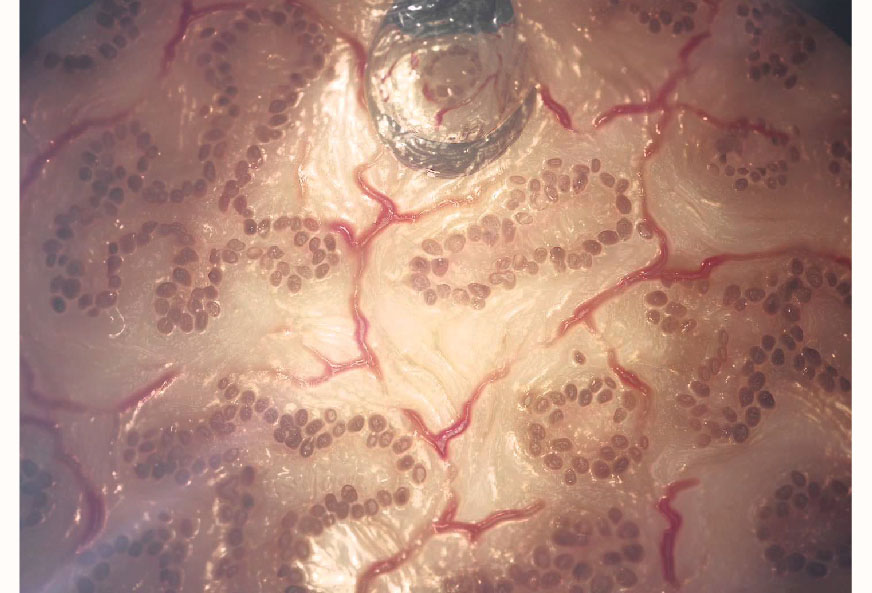 인체이식 이미지