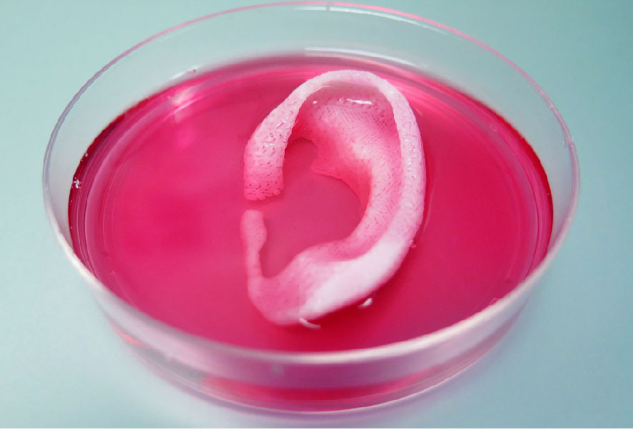 인체이식 이미지