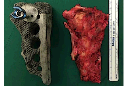 의료기기 이미지