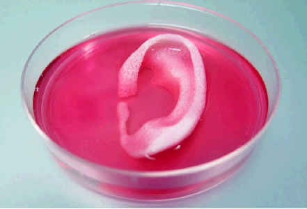 인체이식 이미지